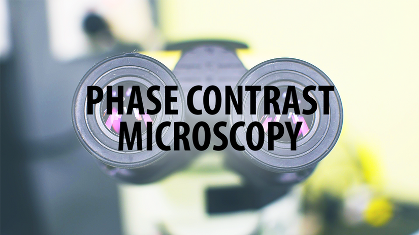 Phase contrast microscopy for the assessment of ram sperm